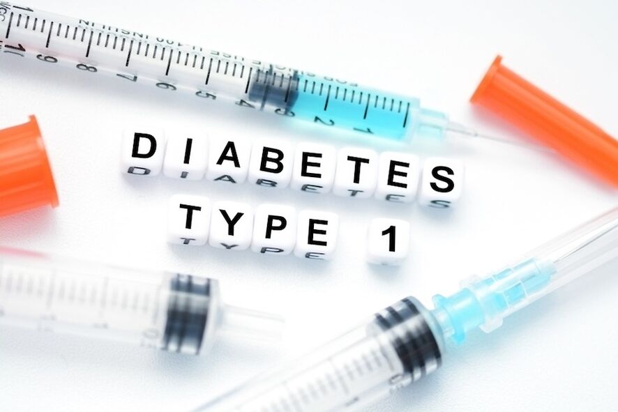 Инсулинът е хормон, необходим на всички пациенти с диабет тип 1. 